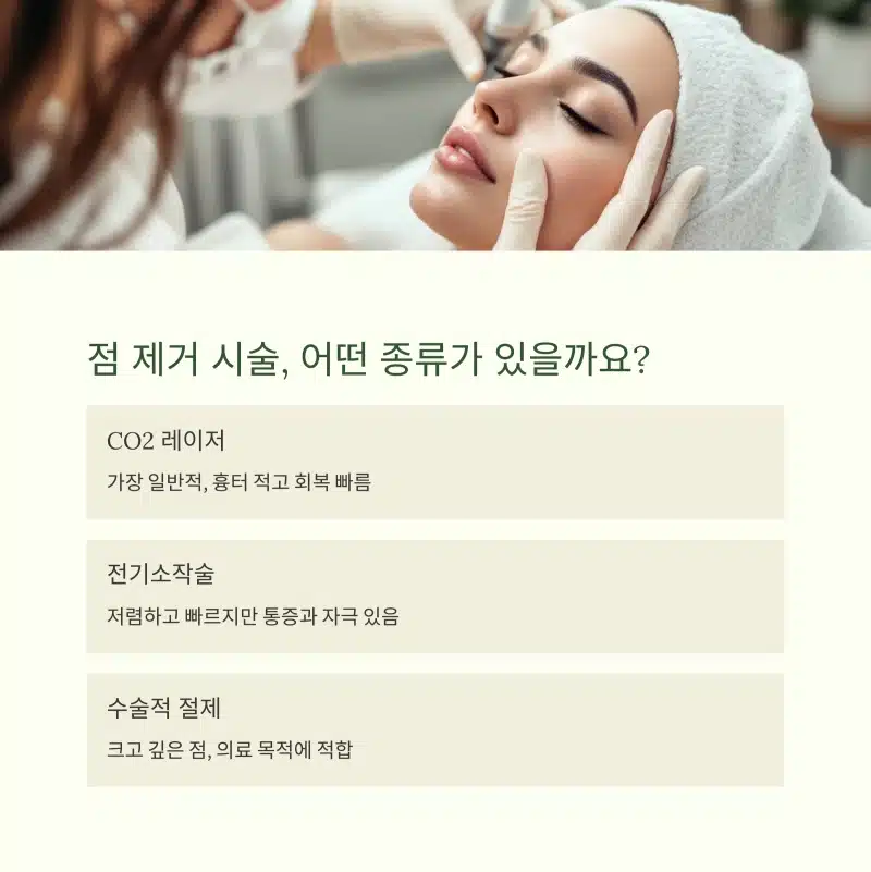 점 제거 시술 종류를 설명하는 이미지. 여성 환자가 시술받는 장면과 함께 CO2 레이저, 전기소작술, 수술적 절제에 대한 간단한 설명이 나열됨.