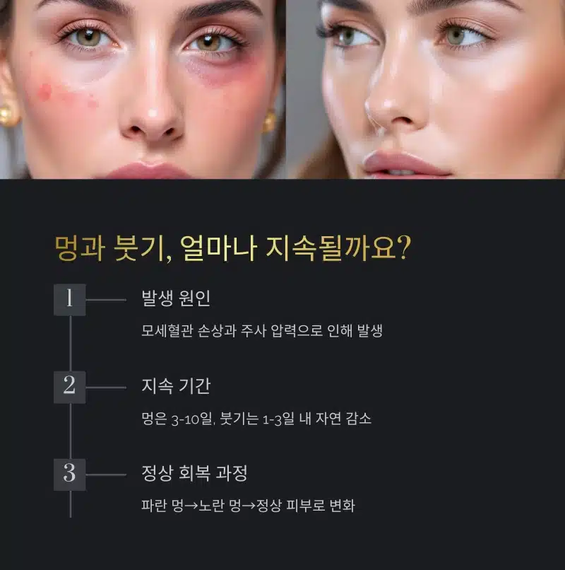 리쥬란 멍과 붓기의 발생 원인과 자연 회복되는 과정에 대한 안내 이미지