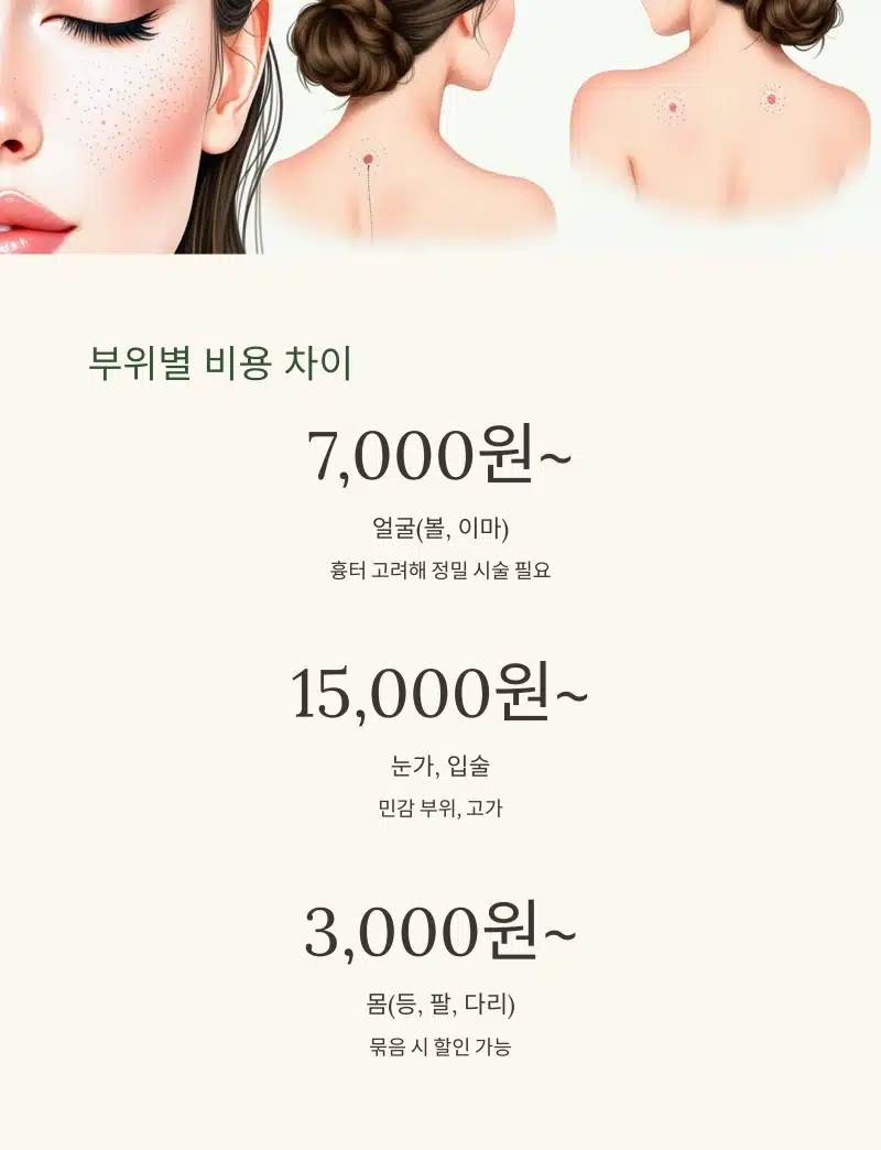 점 제거 부위별 평균 비용을 설명하는 이미지. 얼굴, 눈가·입술, 몸 부위에 따라 3,000원~15,000원 이상 가격 차이를 시각적으로 표현.
